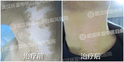 �����װ߶Ա� �人.jpg