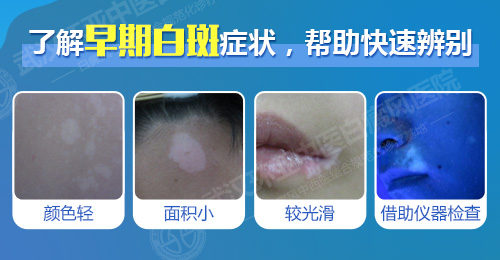 早期白斑症状