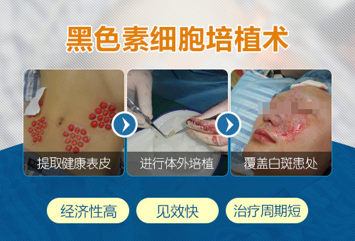 46-稳定期白癜风手术治疗,高效祛白快车道-2.jpg