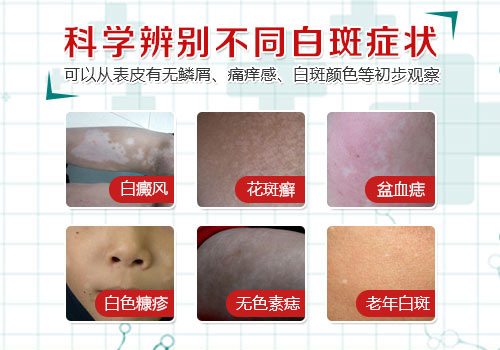 8-被忽视的腿部白斑,该如何应对?-2.jpg