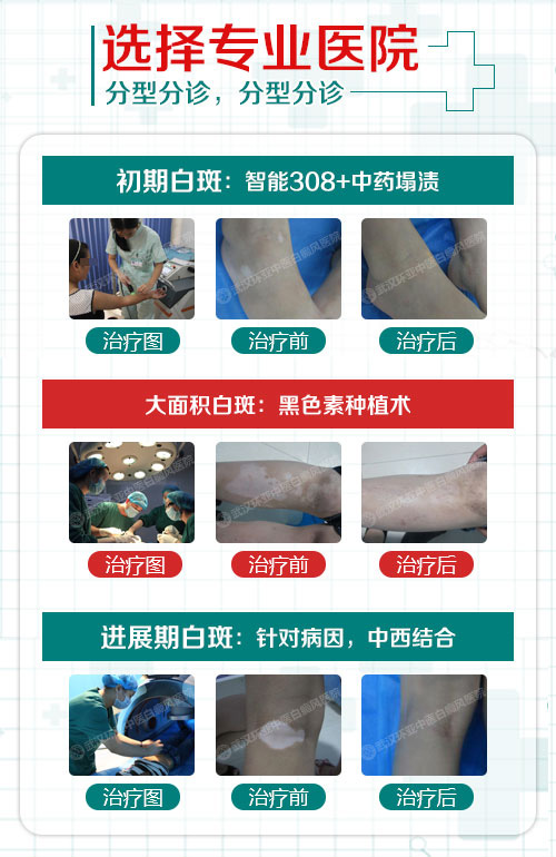8-被忽视的腿部白斑,该如何应对?-3.jpg