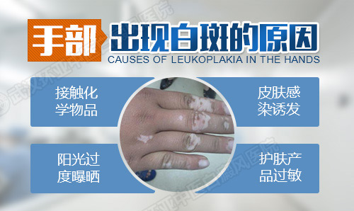 45-手臂出现小白斑.jpg